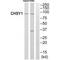 Chondroitin Sulfate Synthase 1 antibody, A07580, Boster Biological Technology, Western Blot image 