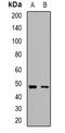 Immunoglobulin Heavy Constant Mu antibody, orb382656, Biorbyt, Western Blot image 