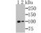 MutS Homolog 2 antibody, NBP2-76898, Novus Biologicals, Western Blot image 