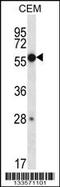 Zinc Finger Protein 764 antibody, 57-016, ProSci, Western Blot image 