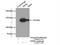 Tripeptidyl Peptidase 2 antibody, 14120-1-AP, Proteintech Group, Immunoprecipitation image 