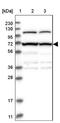 Zinc Finger And BTB Domain Containing 5 antibody, NBP2-13536, Novus Biologicals, Western Blot image 