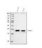 High Mobility Group Nucleosomal Binding Domain 2 antibody, A04839-2, Boster Biological Technology, Western Blot image 