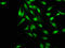 MAGE Family Member D2 antibody, LS-C398295, Lifespan Biosciences, Immunofluorescence image 