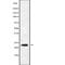 RAB9B, Member RAS Oncogene Family antibody, abx218139, Abbexa, Western Blot image 