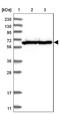 Transmembrane And Coiled-Coil Domains 6 antibody, NBP1-83463, Novus Biologicals, Western Blot image 