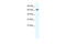 Gamma-Aminobutyric Acid Type A Receptor Beta2 Subunit antibody, 28-272, ProSci, Western Blot image 