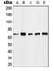 MAGE Family Member A6 antibody, orb214222, Biorbyt, Western Blot image 