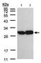 TPI antibody, ab96696, Abcam, Western Blot image 