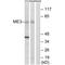 Malic Enzyme 3 antibody, A05164, Boster Biological Technology, Western Blot image 