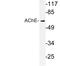 Acetylcholinesterase antibody, LS-C177734, Lifespan Biosciences, Western Blot image 