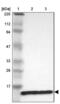 Ribosomal Protein L30 antibody, NBP1-82855, Novus Biologicals, Western Blot image 