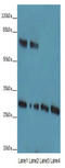 Spindlin Family Member 3 antibody, A65134-100, Epigentek, Western Blot image 