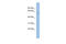 Mucolipin 3 antibody, ARP35278_P050, Aviva Systems Biology, Western Blot image 