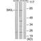 SKI Like Proto-Oncogene antibody, A04131, Boster Biological Technology, Western Blot image 