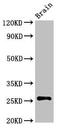 Achaete-Scute Family BHLH Transcription Factor 1 antibody, orb401144, Biorbyt, Western Blot image 