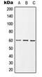 Growth Factor Receptor Bound Protein 10 antibody, GTX32187, GeneTex, Western Blot image 
