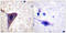 BH3 Interacting Domain Death Agonist antibody, LS-C198682, Lifespan Biosciences, Immunohistochemistry paraffin image 