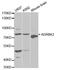 G Protein-Coupled Receptor Kinase 3 antibody, PA5-76023, Invitrogen Antibodies, Western Blot image 