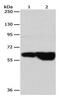 G Protein-Coupled Receptor Kinase 4 antibody, PA5-49703, Invitrogen Antibodies, Western Blot image 