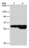 G protein-coupled receptor kinase 4 antibody, PA5-49703, Invitrogen Antibodies, Western Blot image 