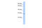 Tissue Factor Pathway Inhibitor 2 antibody, 27-148, ProSci, Western Blot image 