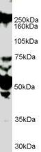 Roundabout Guidance Receptor 1 antibody, GTX89308, GeneTex, Western Blot image 