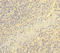 Endothelial Cell Adhesion Molecule antibody, LS-C318579, Lifespan Biosciences, Immunohistochemistry paraffin image 
