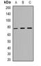 Zinc Finger Protein 7 antibody, orb382460, Biorbyt, Western Blot image 