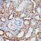 Isocitrate Dehydrogenase (NAD(+)) 3 Alpha antibody, 15-650, ProSci, Immunohistochemistry paraffin image 