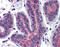 Ras Homolog Family Member A antibody, 51-881, ProSci, Immunohistochemistry paraffin image 