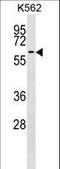 Coagulation factor IX antibody, LS-C167892, Lifespan Biosciences, Western Blot image 