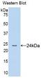 Anterior Gradient 2, Protein Disulphide Isomerase Family Member antibody, LS-C292376, Lifespan Biosciences, Western Blot image 
