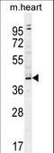 EG382639 antibody, LS-C160725, Lifespan Biosciences, Western Blot image 