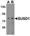 Sushi Domain Containing 1 antibody, A15778, Boster Biological Technology, Western Blot image 