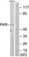 Eukaryotic Translation Initiation Factor 2 Alpha Kinase 2 antibody, LS-C118226, Lifespan Biosciences, Western Blot image 