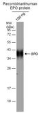 Erythropoietin antibody, GTX100813, GeneTex, Western Blot image 
