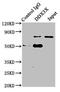 DEAD-Box Helicase 3 X-Linked antibody, LS-C369547, Lifespan Biosciences, Immunoprecipitation image 