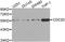 Cell Division Cycle 20 antibody, LS-B12892, Lifespan Biosciences, Western Blot image 