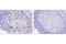 DNA Topoisomerase II Alpha antibody, 12286P, Cell Signaling Technology, Immunohistochemistry paraffin image 
