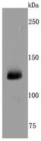 Integrin Subunit Alpha 2b antibody, NBP2-66757, Novus Biologicals, Western Blot image 