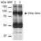 ENaC-Beta antibody, SMC-241D-APC, StressMarq, Western Blot image 