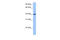 Calponin 2 antibody, 30-790, ProSci, Western Blot image 