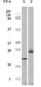 Eukaryotic Translation Initiation Factor 4E Binding Protein 1 antibody, NB110-60514, Novus Biologicals, Western Blot image 