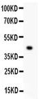 Mesothelin antibody, PA5-79697, Invitrogen Antibodies, Western Blot image 