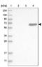 Complement C8 Beta Chain antibody, NBP1-85990, Novus Biologicals, Western Blot image 