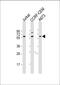 Chaperonin Containing TCP1 Subunit 8 Like 2 antibody, M16124, Boster Biological Technology, Western Blot image 