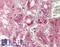 Cathepsin V antibody, LS-B8747, Lifespan Biosciences, Immunohistochemistry frozen image 