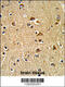 Protein Disulfide Isomerase Family A Member 6 antibody, 62-386, ProSci, Immunohistochemistry paraffin image 