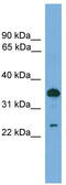 Tumor Protein D52 antibody, TA346594, Origene, Western Blot image 